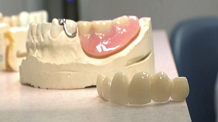 Ontario budget expected to include free dental care for ...